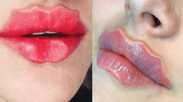 Bizarre Beauty Trend Makes Russian Girls Go Crazy For Wavy Lips Odd News