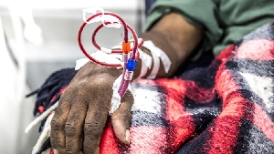 Many hospitals in Ghana lack dialysis machines