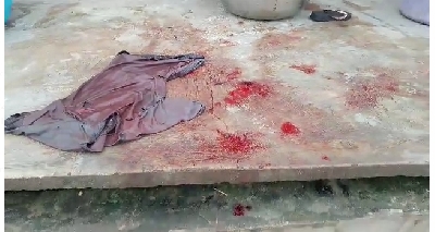 Paa's shirt soaked in blood