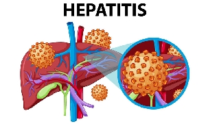 Hepatitis B