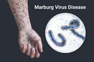 Marburg virus